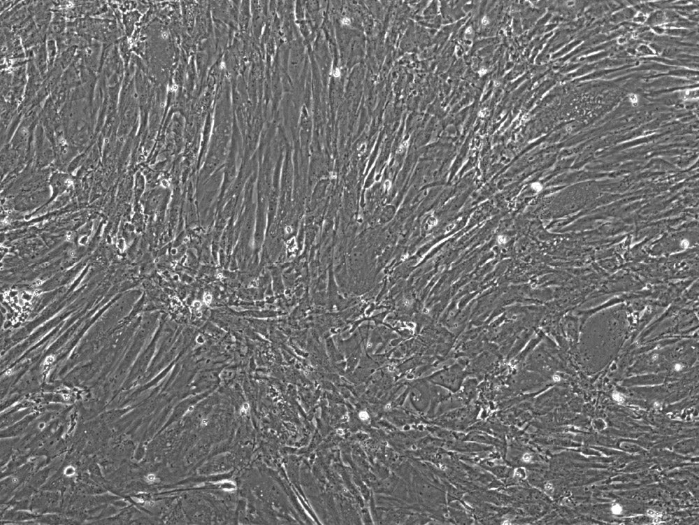 Human Ovarian Carcinoma Cancer-Associated Fibroblasts (CAFs
