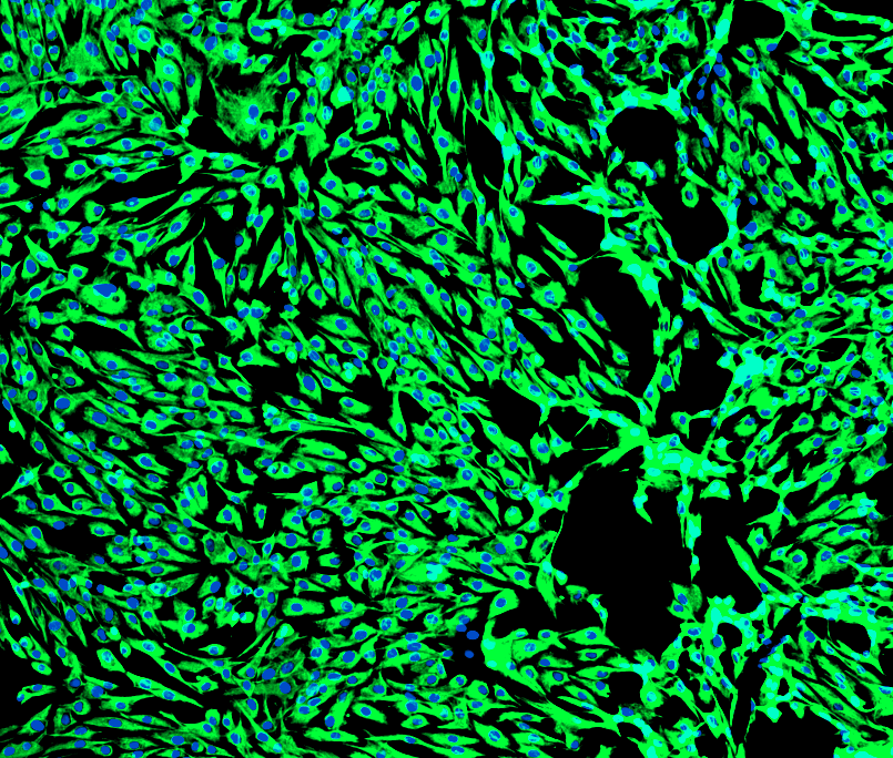 Human Gastric Cancer-Associated Fibroblasts (CAFs): 1,000,000 Cells