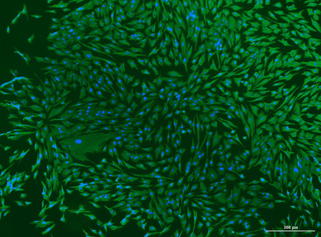 Human Colorectal Fibroblasts: 1,000,000 Cells