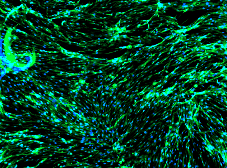 Human Lung Fibroblasts: 1,000,000 Cells