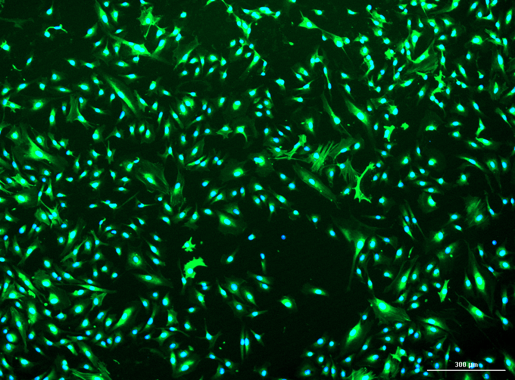 Human Prostate Cancer Associated Fibroblasts: 1,000,000 Cells Per Vial