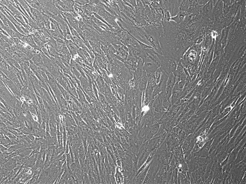 Human Bone Marrow Derived MSCs: 500,000 Cells Per Vial
