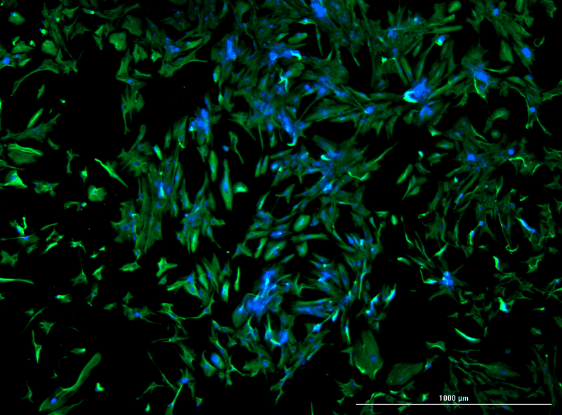 Human Renal Fibroblasts Stained with Vimentin