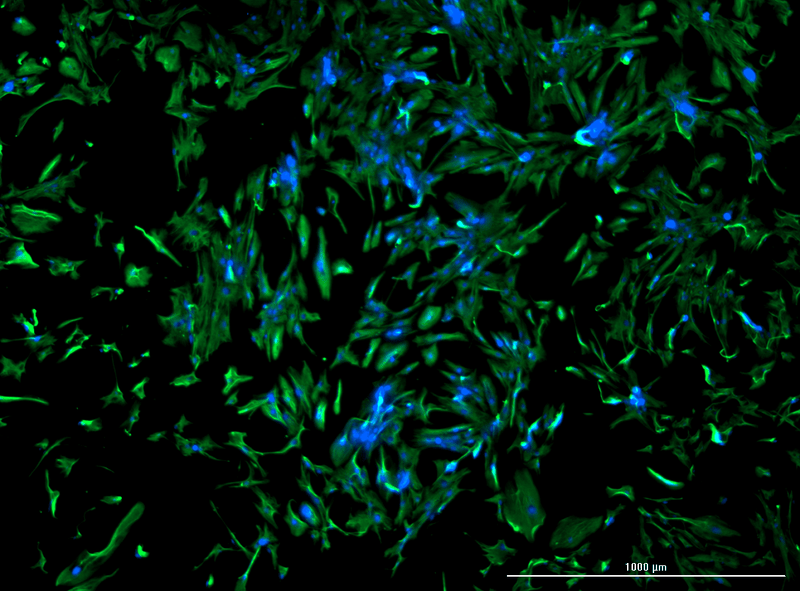 Human Renal Fibroblasts Stained with Vimentin Human Renal Fibroblasts Stained with Vimentin