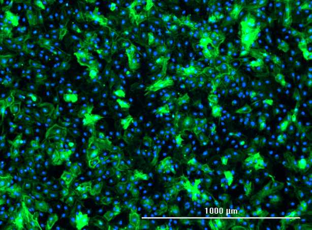 Human Glioblastoma Cancer Associate Fibroblasts