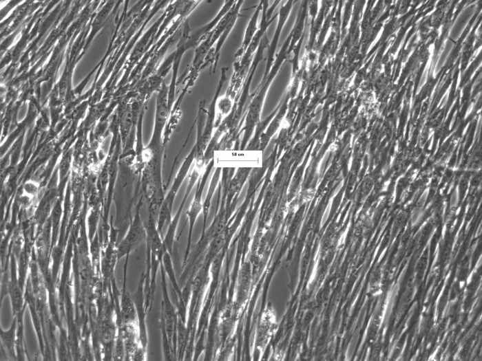 Human Pancreatic Stellate Cancer Associate Fibroblasts