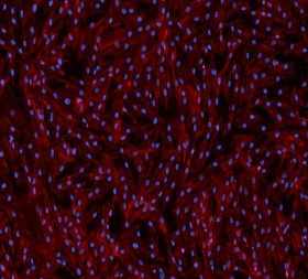 Human Pancreatic Fibroblasts